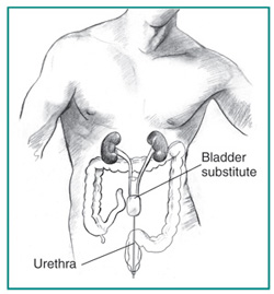 Urology Glossary Terms