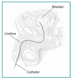 Urology Glossary Terms