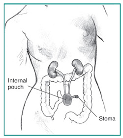 Urology Glossary Terms