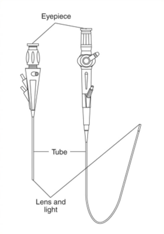 ureteroscopy