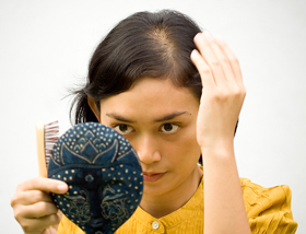 Female Hair Loss (Balding)