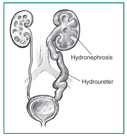 Urology Glossary Terms