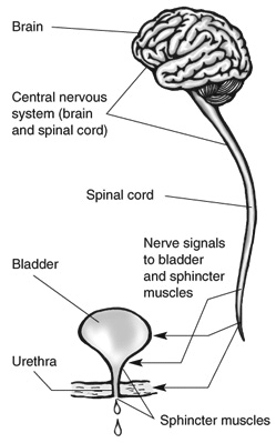 Nerve control of bladder - neurogenic bladder