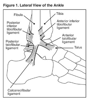 Ankle Sprain