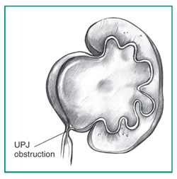 Urology Glossary Terms