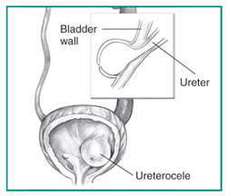 Urology Glossary Terms